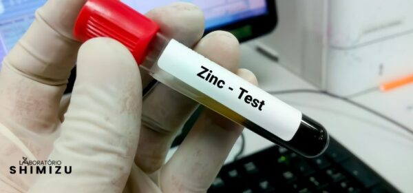 Mergulhando no Mundo do Zinco: Como Avaliar seus Níveis com Exames de ...